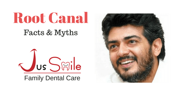 root canal treatment