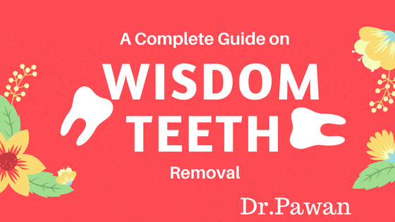 Wisdom teeth removal done at ramchandras jussmile dental clinic nearby kolathur,chennai